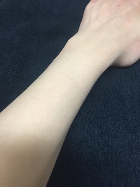 %e5%82%b7